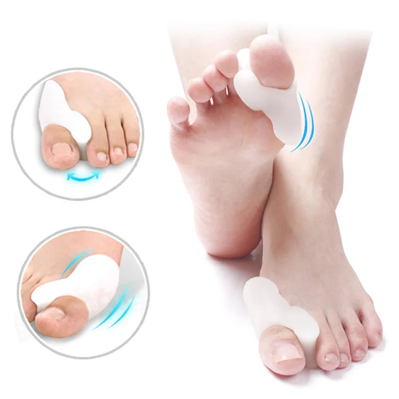 Bunion Corrector